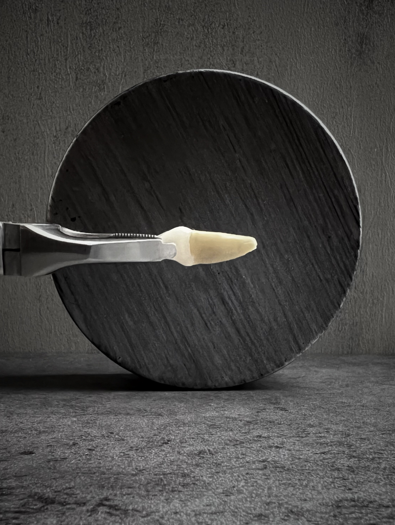 EXTRACTION OF WISDOM TEETH