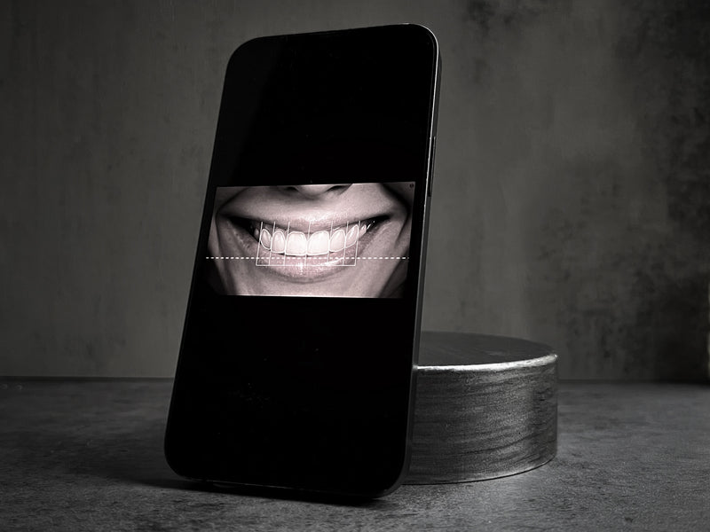 Smile Makeover